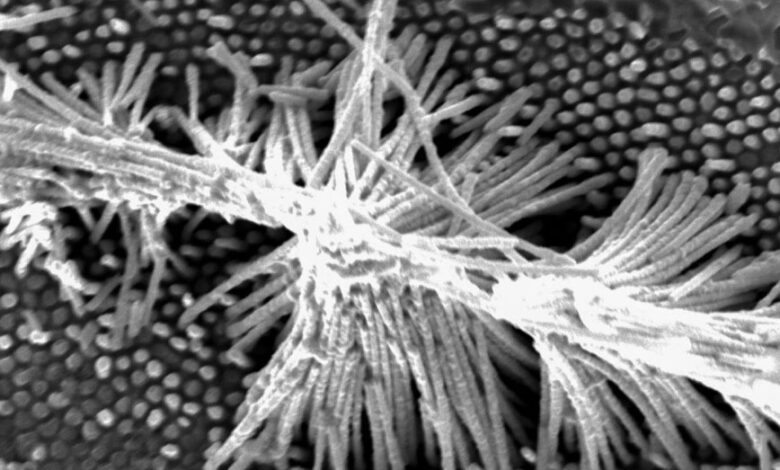 Scanning electron microscopy image offers a top-down view of the single-crystalline Mo4P3 nanowires fabricated by thermomechanical nanomolding.