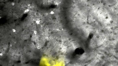 Two-photon microscopy image of the nanoelectrode (yellow) after two months implanted inside a mouse brain, with healthy active neurons (bright area) around the implant