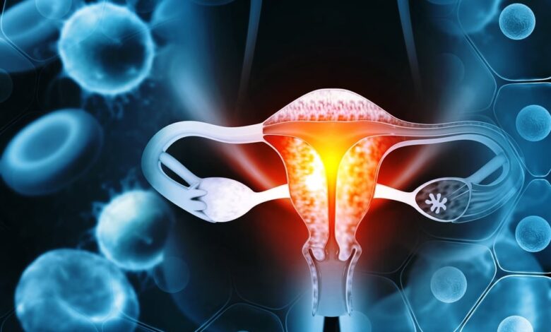 Endometrial cancer drug gets the title of breakthrough therapy